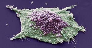 Study suggests small cell lung cancer should not be treated as single disease