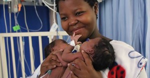 Uwenzile and Uyihlelile Shilongonyane with their mom, Bongekile Simelane, minutes before they underwent their separation surgery .