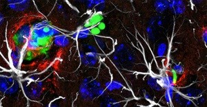 Limiting lung cancer's spread and growth in the brain
