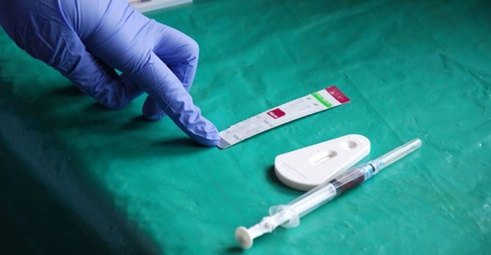 Zambia makes HIV testing compulsory