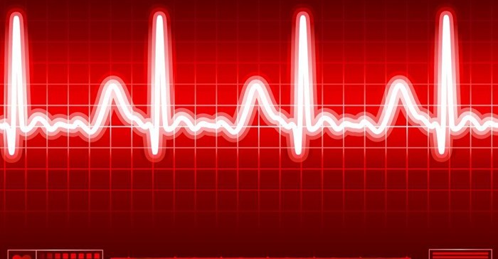 No - heart disease is not SA's leading cause of death