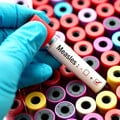 Measles outbreak in KZN