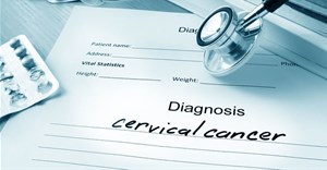 IUDs lower risk of getting cervical cancer