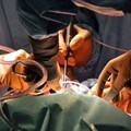 Study: African surgical patients twice as likely to die