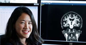 Sharon Sha, clinical associate professor of neurology and neurological sciences at Stanford University School of Medicine. Photo: Paul Sakuma