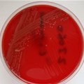 A lab sample of the bacteria listeria monocytogene that causes listeriosis.