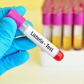 WHO offers regional support in listeriosis crisis