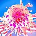 Viral suppression helps lower risk for many types of cancer, study finds