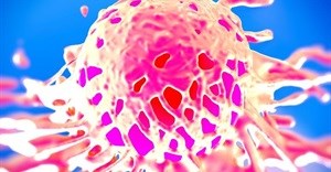 Viral suppression helps lower risk for many types of cancer, study finds