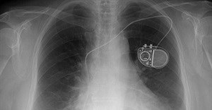 Why medical devices should carry warranties