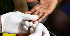 The WHO recommends testing for HIV every 6 to 12 months. Shutterstock