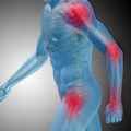 There’s a significant variation in pain sensitivity and tolerance. Shutterstock
