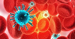 Yale scientists examine how an immune system protein helps suppress HIV