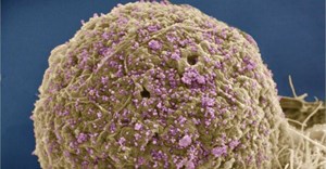 The human immunodeficiency virus (HIV), shown here as tiny purple spheres, causes the disease known as AIDS. Mark Ellisman and Tom Deerinck, National Center for Microscopy and Imaging Research