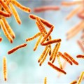 TB, which is caused by the bacterium Mycobacterium Tuberculosis, is a leading cause of death. Kateryna Kon/Shutterstock
