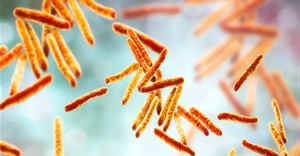 TB, which is caused by the bacterium Mycobacterium Tuberculosis, is a leading cause of death. Kateryna Kon/Shutterstock