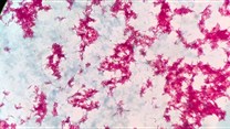 Mycobacterium tuberculosis under the microscope.