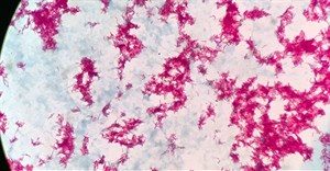 Mycobacterium tuberculosis under the microscope.
