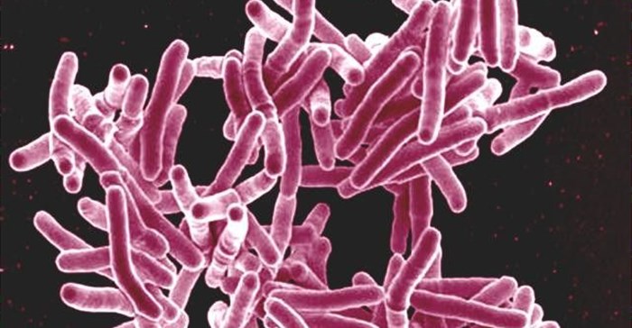 Electron micrograph of Mycobacterium tuberculosis bacteria, the cause of TB. Photo: NIAID via Flickr (CC BY 2.0)