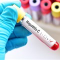 Hepatitis is a major public health burden. Shutterstock