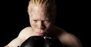 UN expert to assess SA's rights of people with albinism