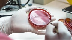 Researchers have evidence of another method that bacteria use to avoid antibiotics. Sirirat/Shutterstock