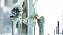 Low-cost alloys would pave the way for affordable medical implants and prosthetics. Monstar Studio/Shutterstock