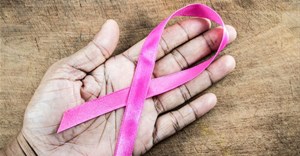 Black women in South Africa are more likely to die from breast cancer than others. NS Natural Queen/Shutterstock