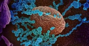 SARS-CoV-2, the virus that causes Covid-19 (round blue objects), emerging from the surface of cells cultured in the lab. Image by the US NIAID (CC BY 2.0)