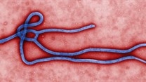Ebola virus virion. CDC/Cynthia Goldsmith