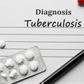 Six-month treatment effective for multi-drug-resistant TB, study finds