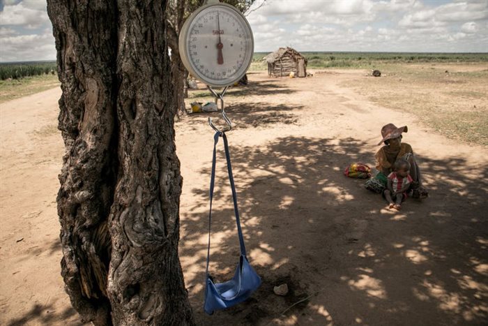 A baby scale hangs on a tree branch during a malnutrition screening session in Ifotaka, southern Madagascar. | Source: Rijasolo/AFP via Getty Images