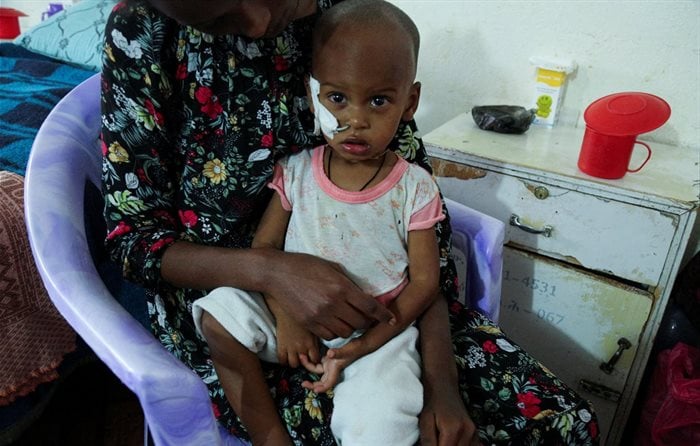 Aamanuel Merhawi, aged one year and eight months, who suffers from severe acute malnutrition, is seen fitted with a nasogastric tube at Wukro hospital in Wukro, Tigray region, Ethiopia July 11 2021. | Source: Reuters/Giulia Paravicini/File photo