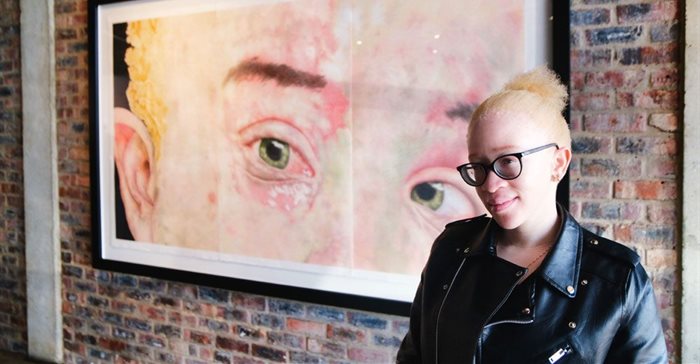 Athenkosi Kwinana is breaking the stigma about Persons Living with Albinism (PLWA) through art