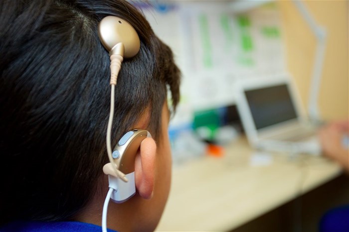 Customised cochlear model pursues hi-fi hearing