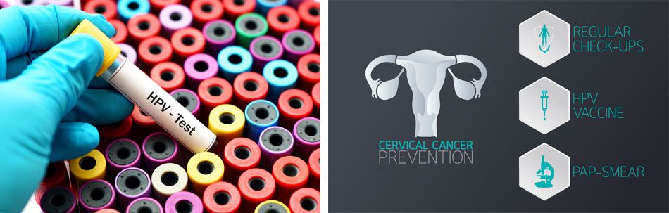Talking about HPV and cervical cancer