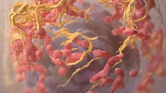 3D structure of a melanoma cell derived by ion abrasion scanning electron microscopy. Image credit:  on
