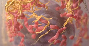 3D structure of a melanoma cell derived by ion abrasion scanning electron microscopy. Image credit:  on