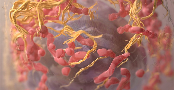 3D structure of a melanoma cell derived by ion abrasion scanning electron microscopy. Image credit:  on